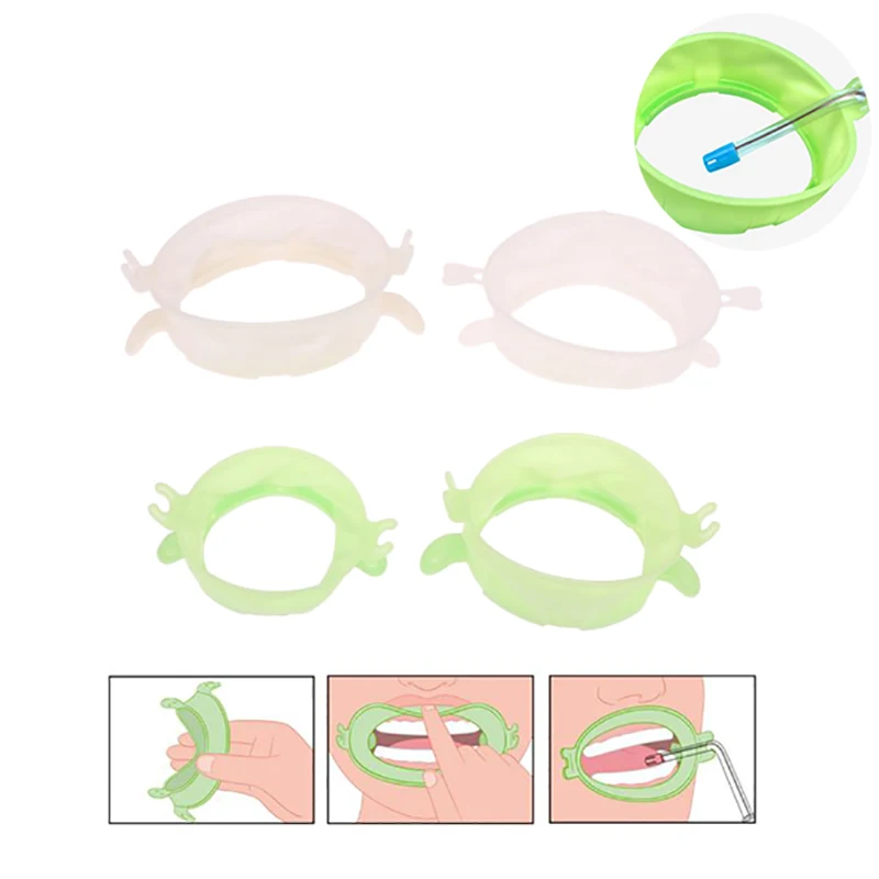 Teeth Whitening Zoom - 3 個 S/M/L 歯科リップ頬リトラクター口オープナー歯ホワイトニング口リップオープナースプレッダー歯科矯正ツール歯科医のため