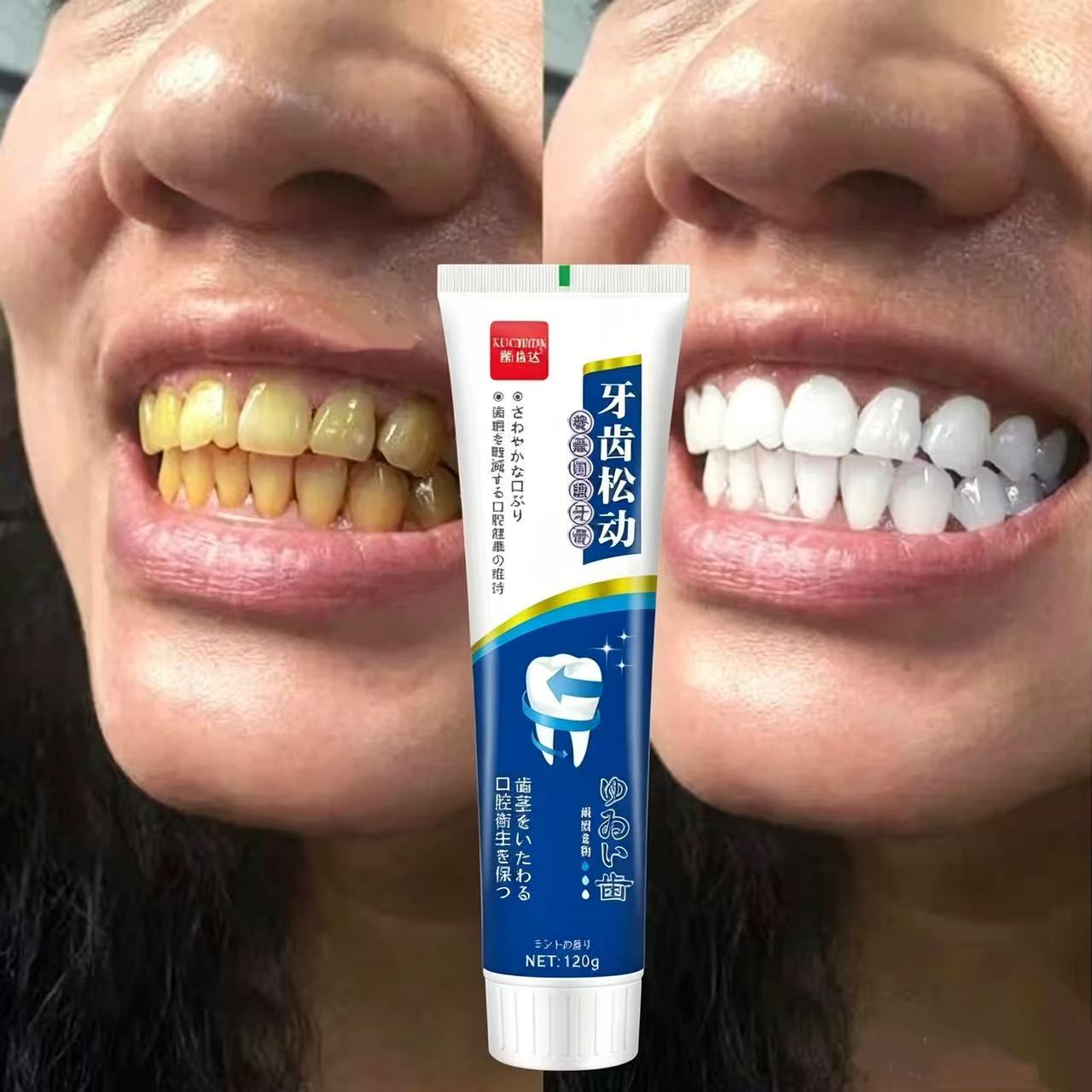 Teeth Whitening Japanese - ゆるんだ歯を補修する 日本輸入歯磨き粉 一年中使える口腔ケア 大人用 男女兼用 ホワイトニング