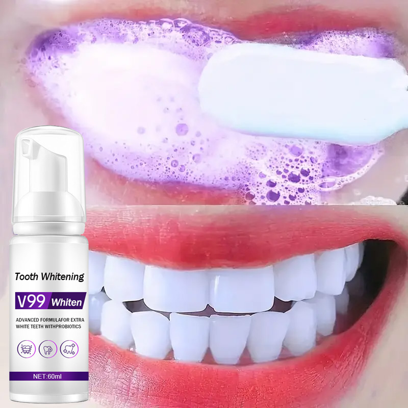 Teeth Whitening Mousse - ムース V99 歯磨き粉歯のクリーニング効果的なホワイトニング歯磨き粉黄色の歯の除去歯の汚れ口腔クリーニング製品 60 ミリリットル