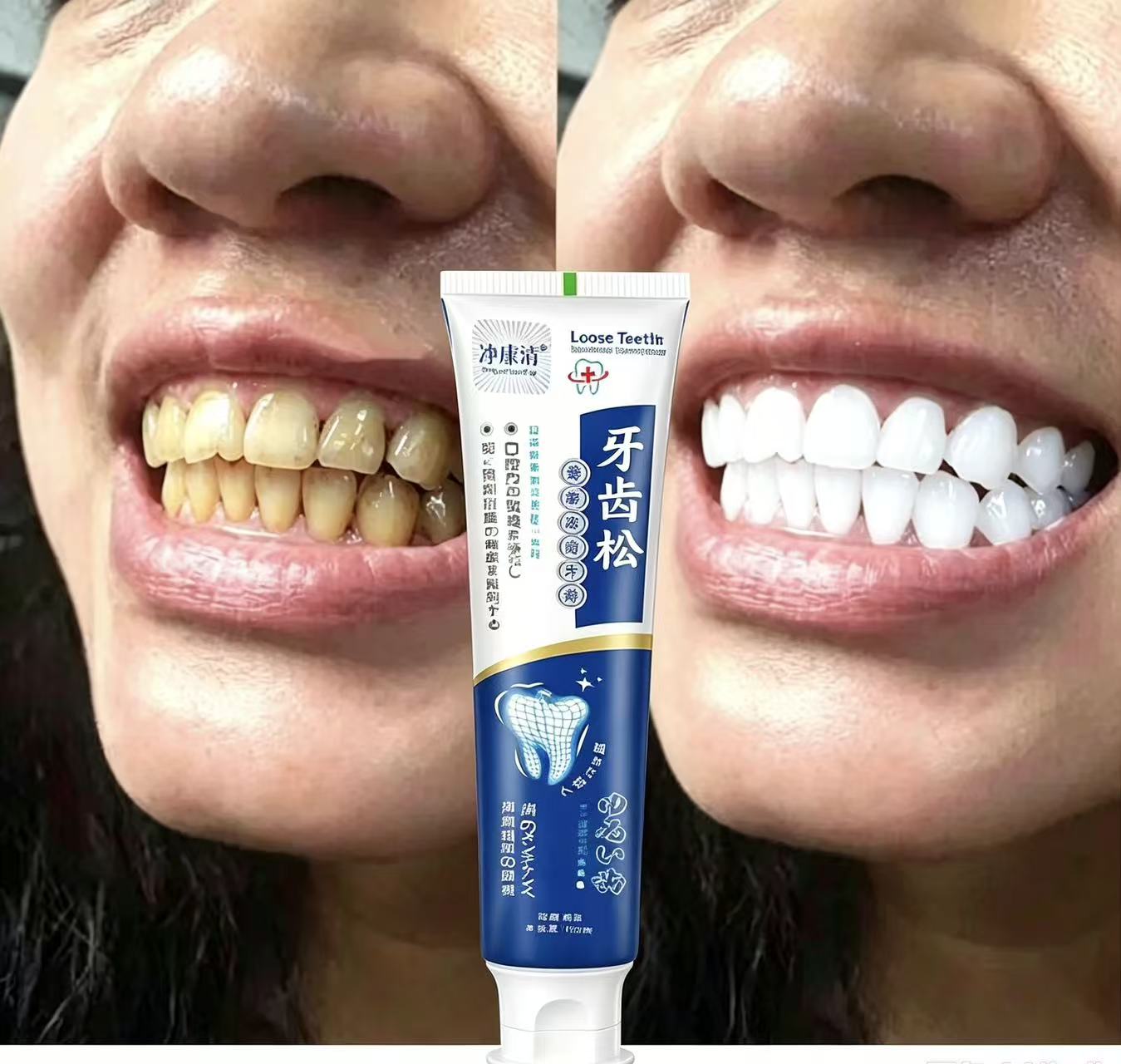 Teeth Whitening Japanese - ゆるんだ歯を補修する日本製歯磨き粉、一年中使える大人用男女兼用ホワイトニングオーラルケア、ブライトニング効果