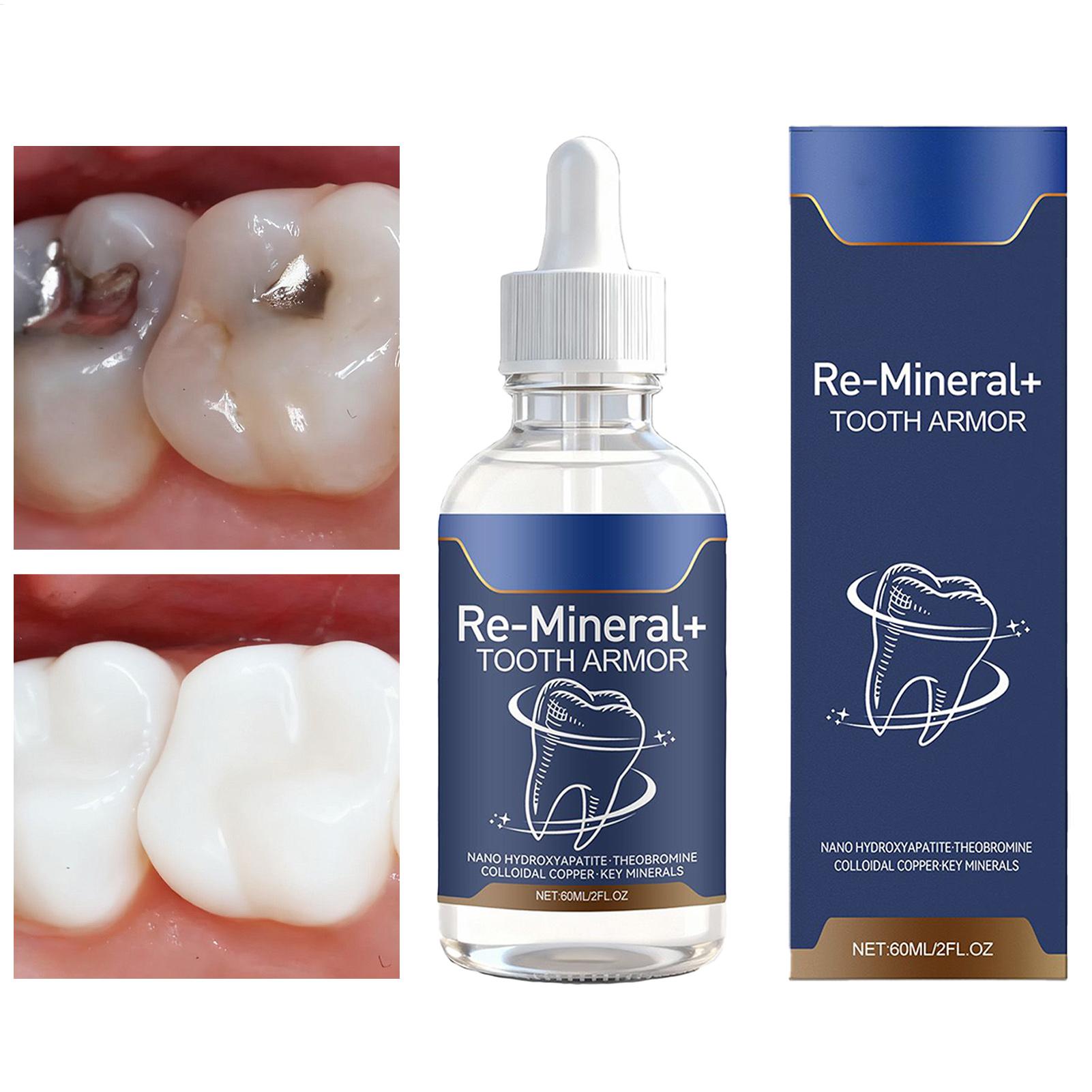 Teeth Whitening And Stain Removal - 60 ミリリットル歯の洗浄液は歯の汚れを除去します歯のホワイトニング歯女性のための歯茎ケア虫歯の洗浄健康救済修理
