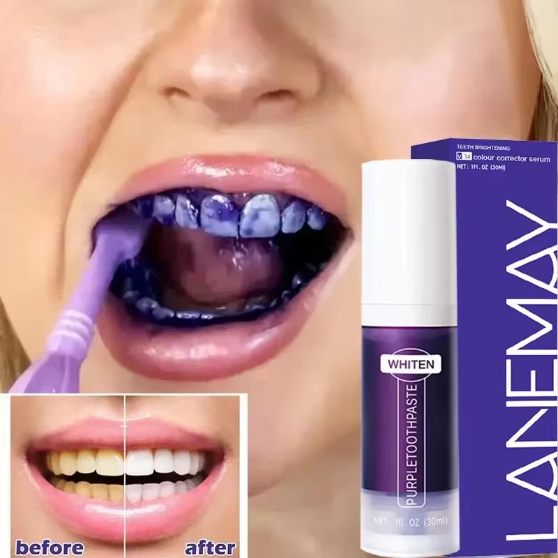 Teeth Whitening Mousse - V34 紫色の歯ホワイトニング歯磨き粉除去歯垢汚れクリーニング口腔衛生歯科漂白ツール新鮮な息美容健康