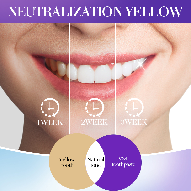 SADOER V34 歯磨き粉、歯をより白くするためのステイ - Teeth Whitening Hismile のレビューと価格