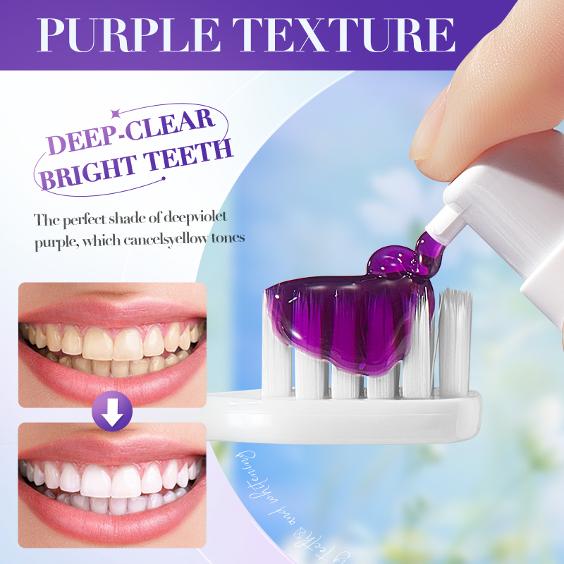 SADOER V34 歯磨き粉、歯をより白くするためのステイ - Teeth Whitening Hismile のレビューと価格