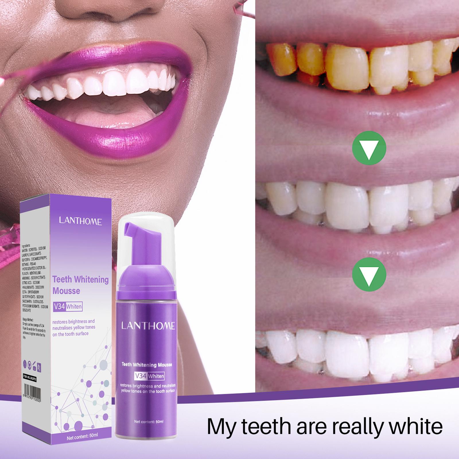 V34 ムース歯クリーニング歯磨き粉効果的な美白歯の除去深い - Teeth Whitening Mousse のレビューと価格