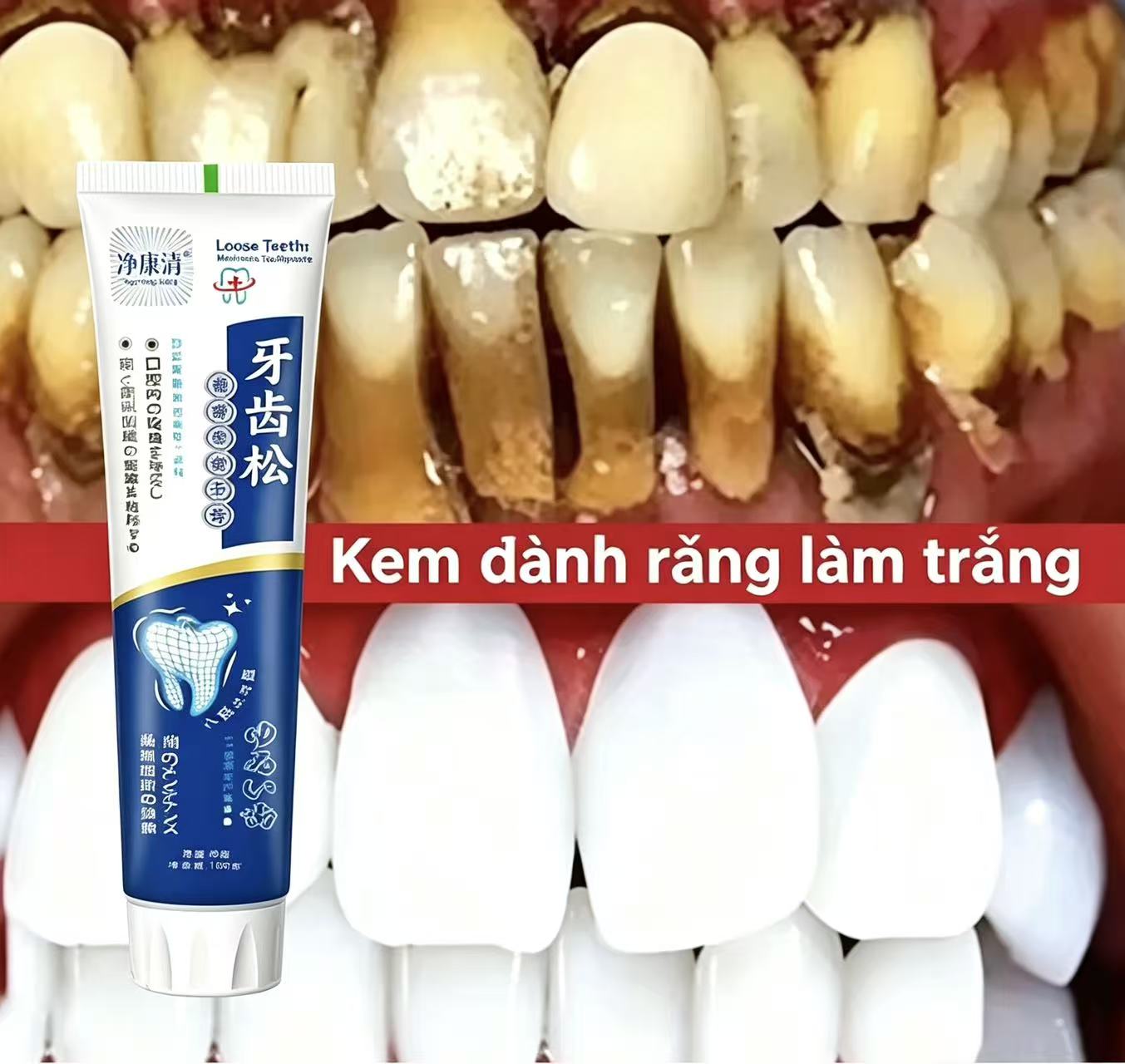 ゆるんだ歯を補修する日本製歯磨き粉、一年中使える大人用男女兼 - Teeth Whitening Japanese のレビューと価格