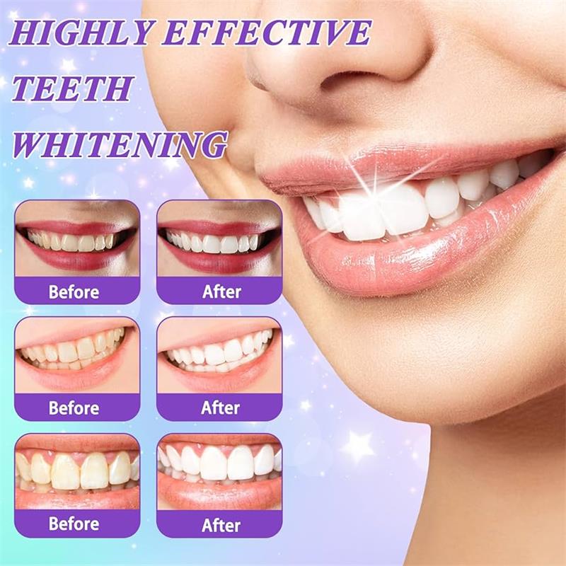 9D パープル歯磨き粉ムース 黄ばんだ歯の汚れ除去用集中ステ - Teeth Whitening Mousse のレビューと価格