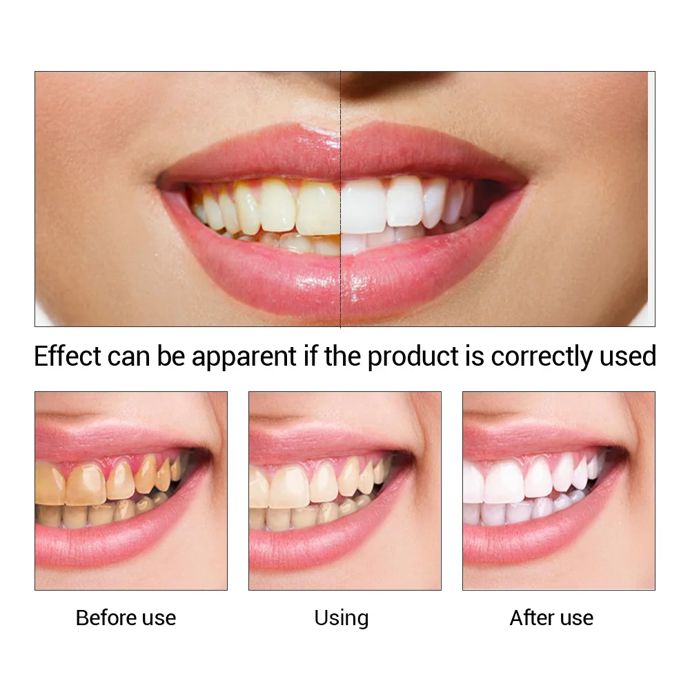 歯のホワイトニングエッセンス,口腔衛生,歯のホワイトニング, - Teeth Whitening Hismile のレビューと価格
