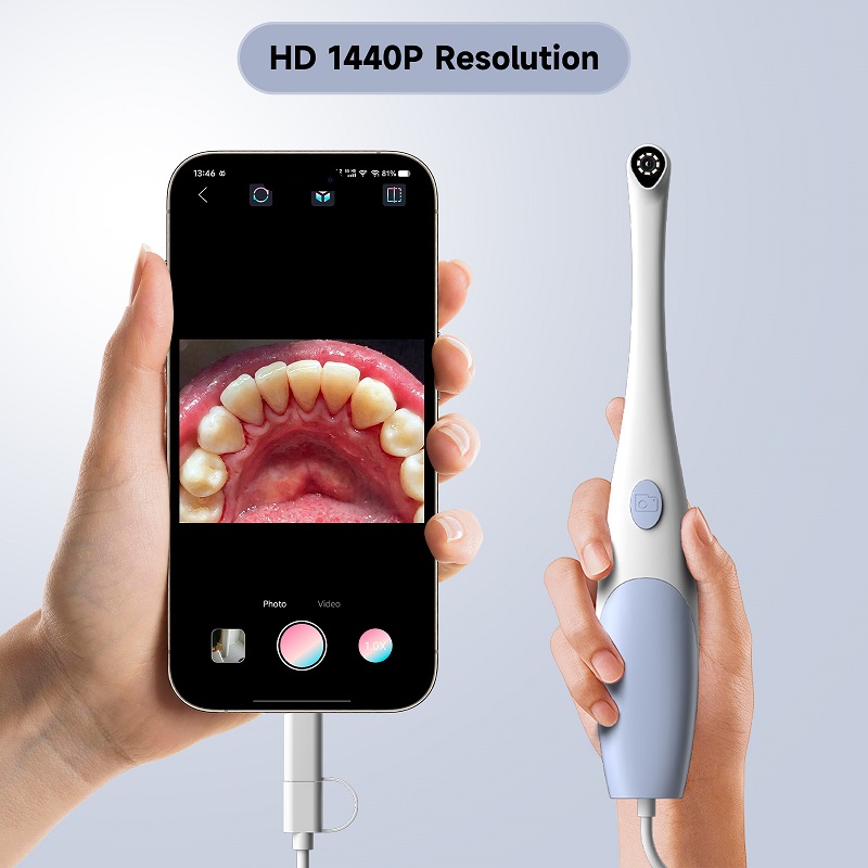 口腔内視鏡カメラ 1440P 写真&ビデオハンドヘルドビジュ - Teeth Whitening Video のレビューと価格