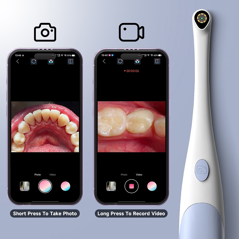 口腔内視鏡カメラ 1440P 写真&ビデオハンドヘルドビジュ - Teeth Whitening Video のレビューと価格