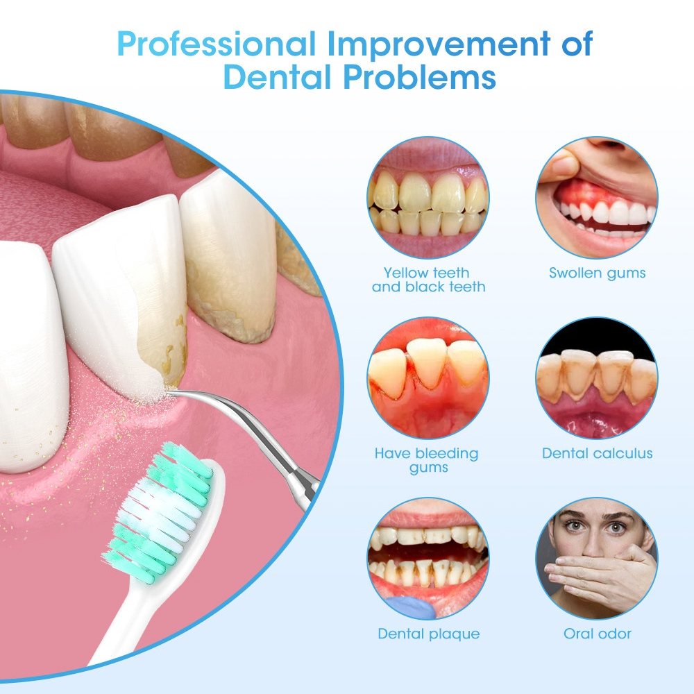 LC-H156X 電動歯石除去器 歯垢除去 コーヒーの染み除 - Teeth Whitening And Stain Removal のレビューと価格