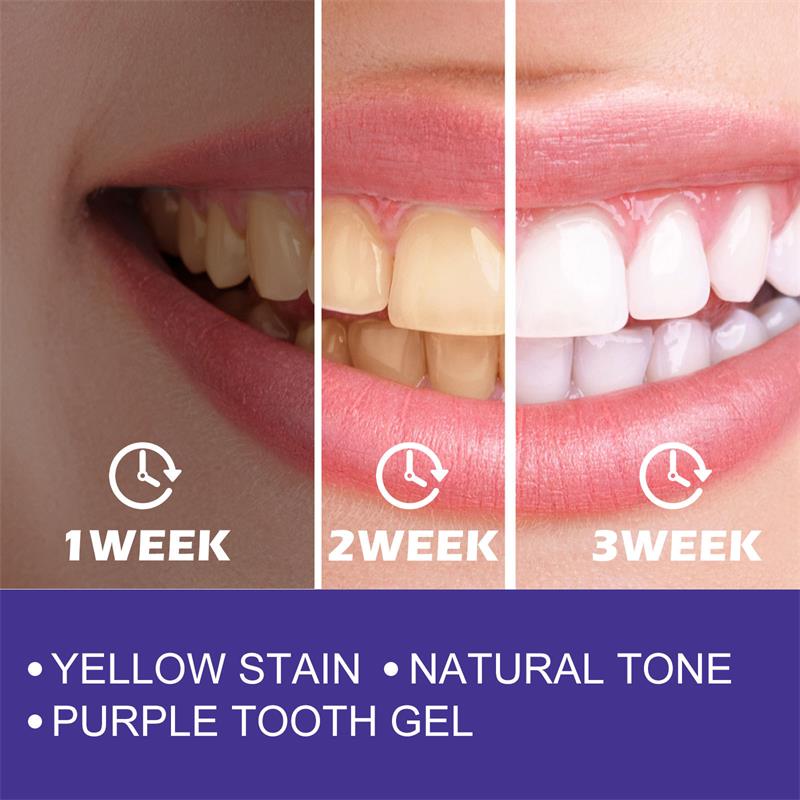 歯のホワイトニングジェルパッチ,ホワイトニング用漂白剤,汚れ - Teeth Whitening In Korea のレビューと価格