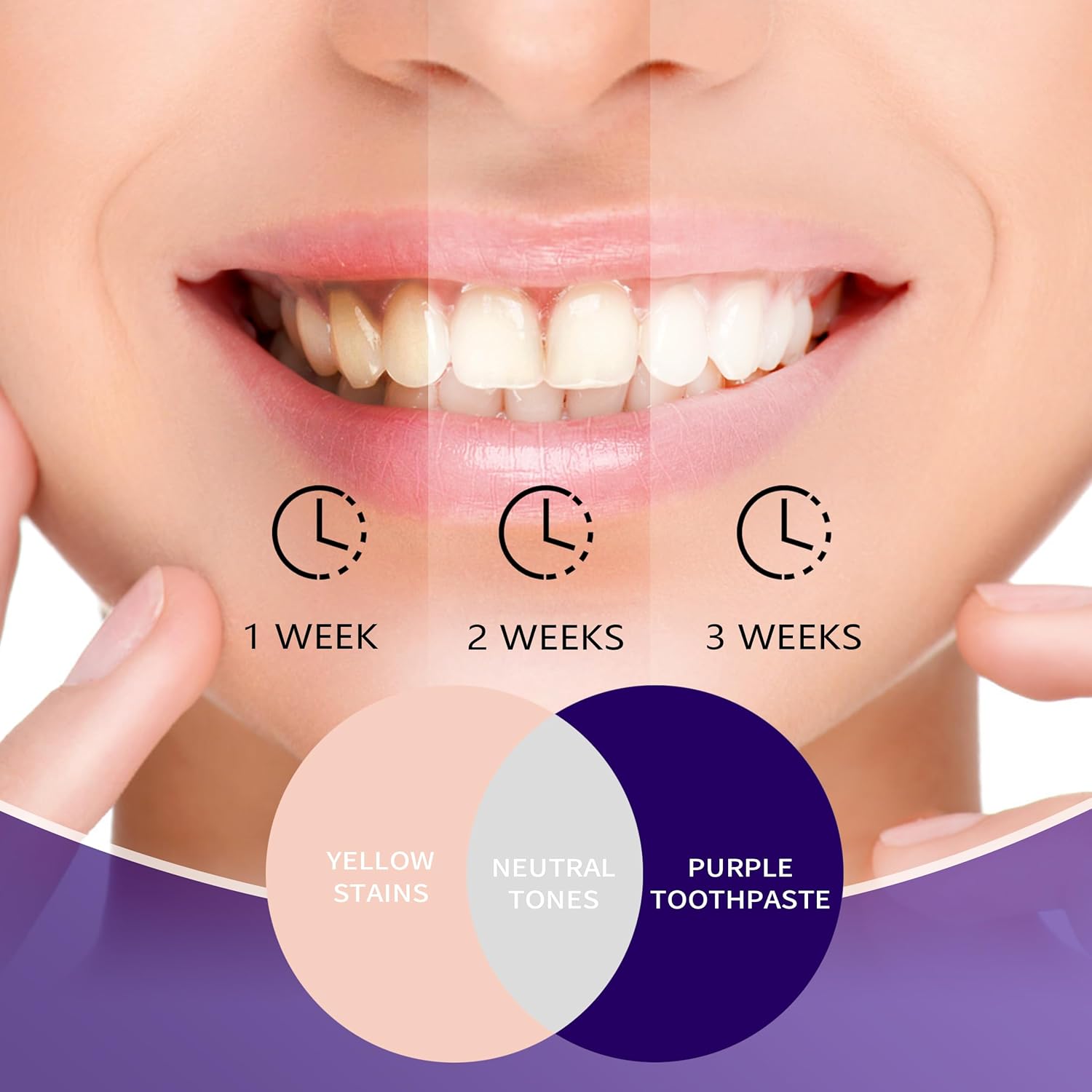 紫色の歯磨き粉で歯を白くする 色補正ホワイトニング歯磨き粉  - Teeth Whitening Mousse のレビューと価格