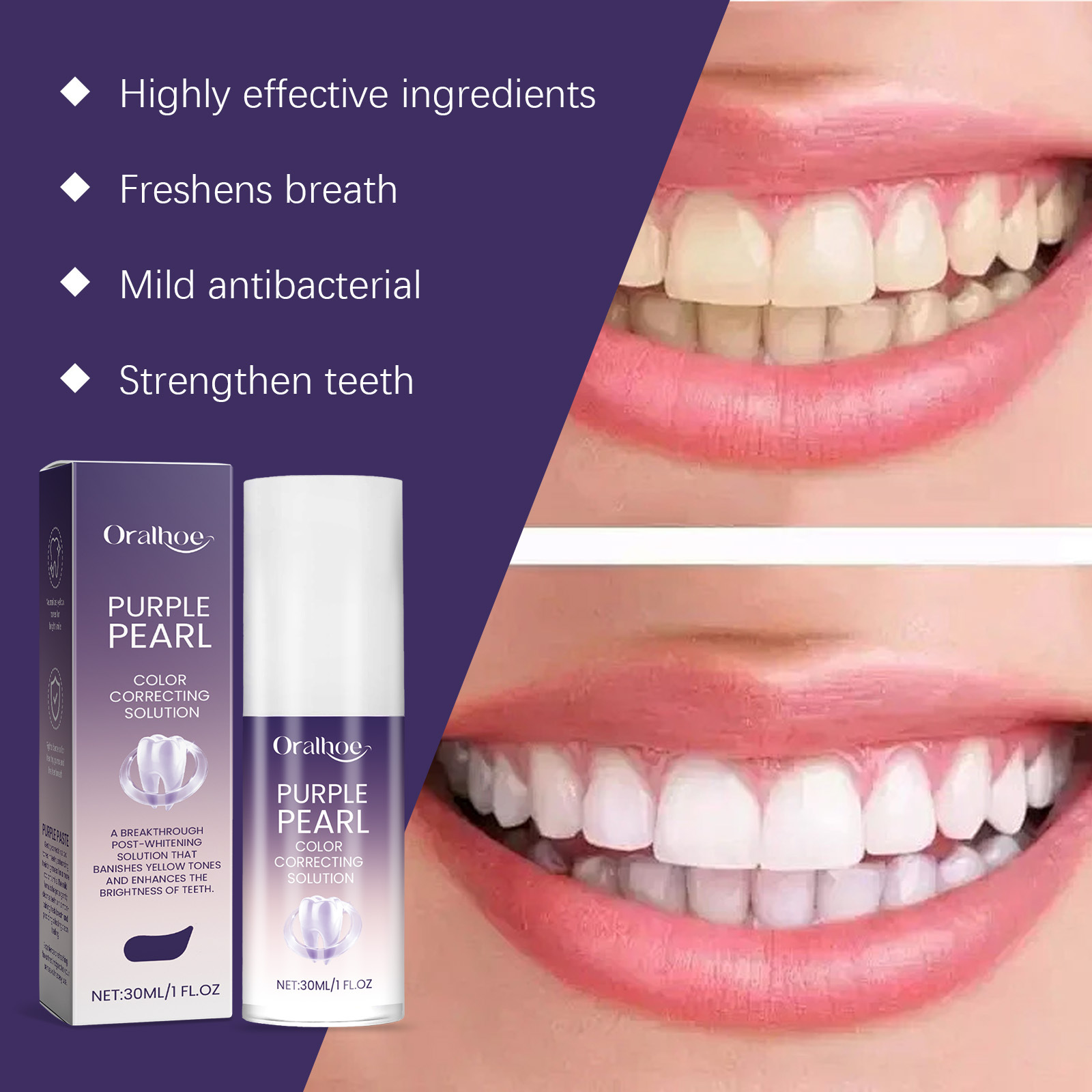 2026年新発売 パープル歯のホワイトニングムース技術 深層 - Teeth Whitening Mousse のレビューと価格
