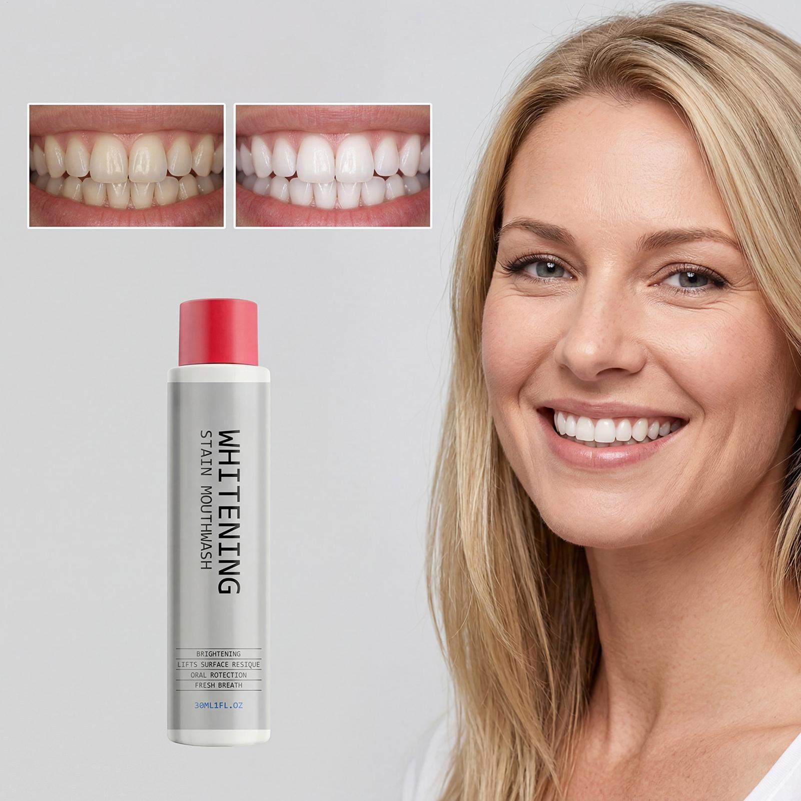 30ml ステインホワイトニングマウスウォッシュ、臭いを除去 - Teeth Whitening And Stain Removal のレビューと価格