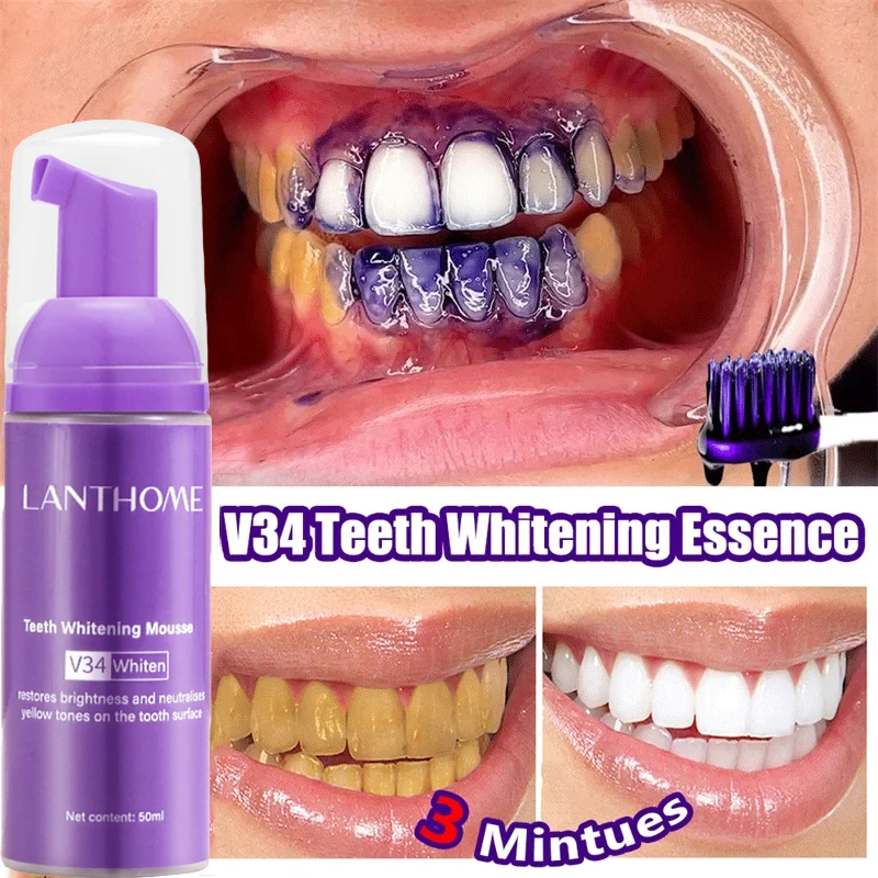 V34 ホワイトニングムース歯磨き粉 歯垢除去 ステイン除去 - Teeth Whitening Mousse のレビューと価格
