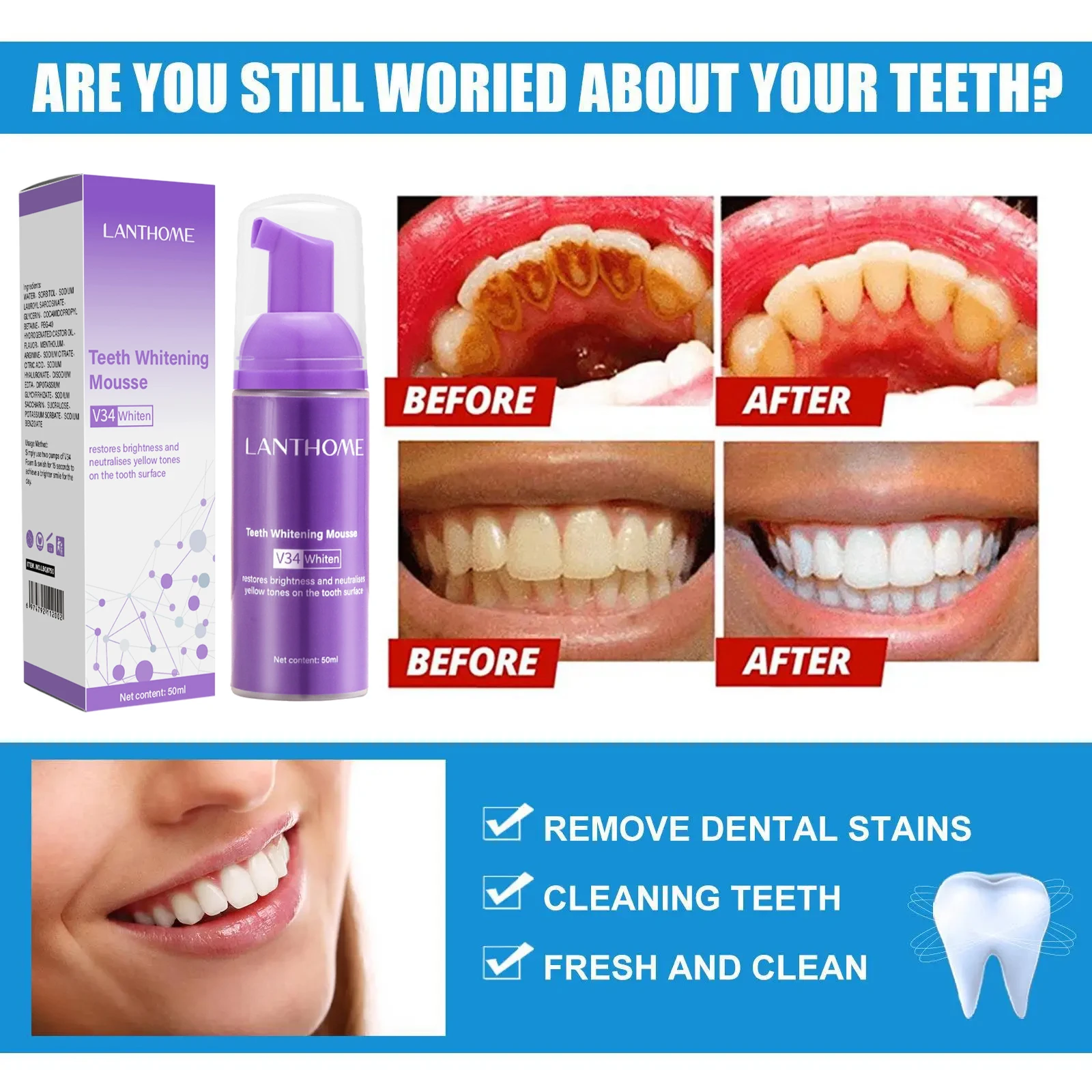 V34 ホワイトニングムース歯磨き粉 歯垢除去 ステイン除去 - Teeth Whitening Mousse のレビューと価格