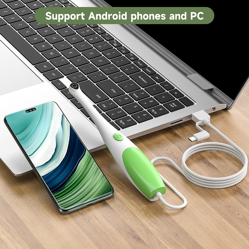 TYPE-C ビジュアル口腔カメラ 3in1 USB ハンド - Teeth Whitening Video のレビューと価格