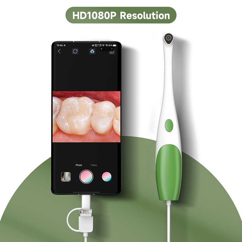 タイプC口腔内視鏡ハンドヘルドビデオ口腔検査カメラ1080P - Teeth Whitening Video のレビューと価格