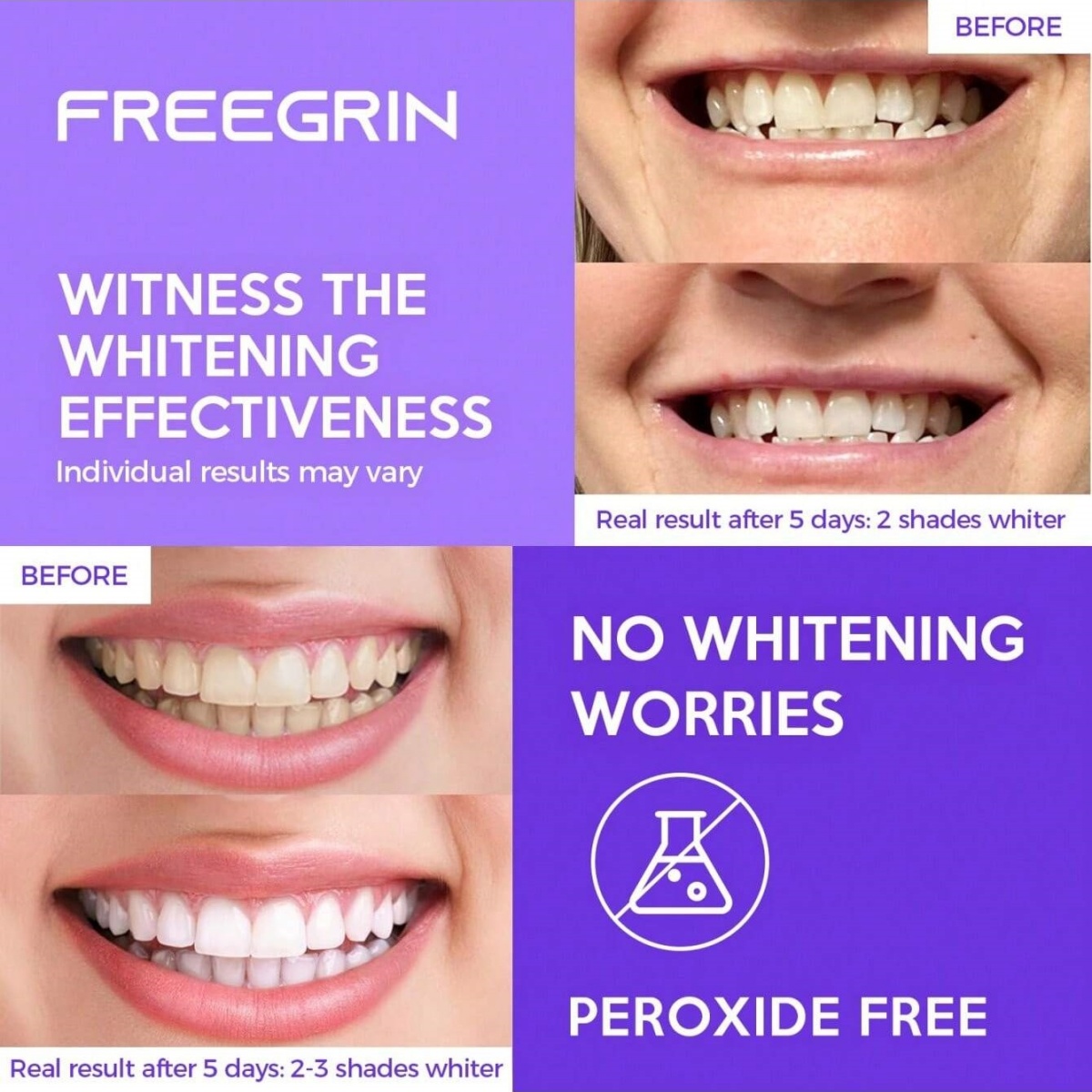 デラックスホワイトニング歯ステッカー 7/14/21 ペアジ - Teeth Whitening Gels のレビューと価格