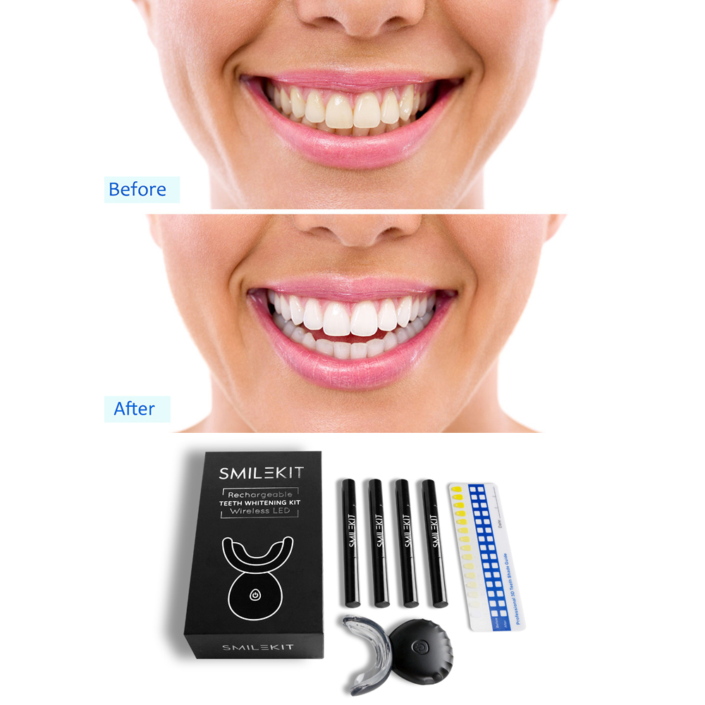 電気歯のホワイトニングキット,歯のホワイトニング用の歯のホワ - Teeth Whitening Led Kit のレビューと価格