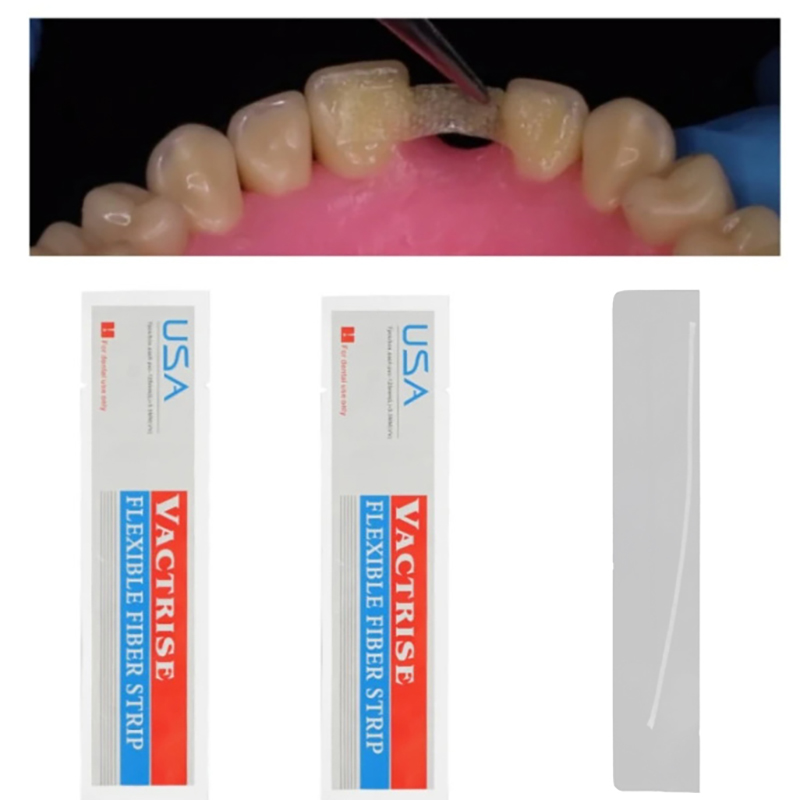 1 個歯科用フレキシブルファイバーストリップガラススプリント - Teeth Whitening Zoom のレビューと価格