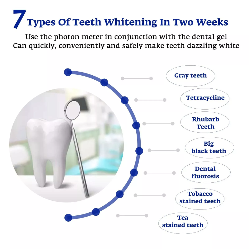 歯のホワイトニング アクセラレーター スマート LED ブル - Teeth Whitening Led Kit のレビューと価格