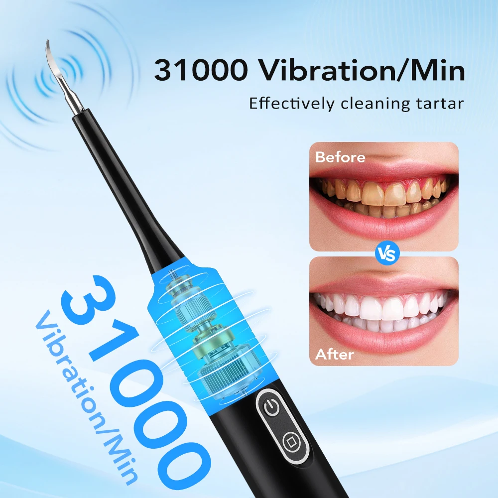 電気音波振動歯科用スケーラー歯のホワイトニング歯垢除去コーヒ - Teeth Whitening And Stain Removal のレビューと価格